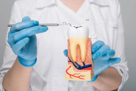 Wurzelkanalbehandlung auch Wurzelbehandlung bei Fair Doctors Zahnarzt