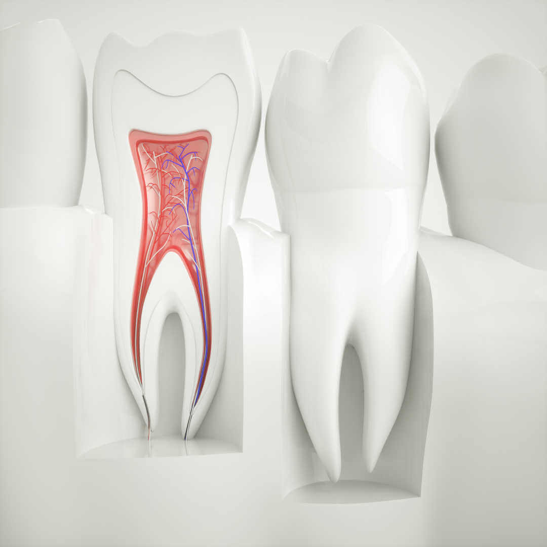 Zahnwurzelbehandlung einer Wurzelentzündung - Wurzelkanalbehandlung - Fair Doctors Zahnarztpraxis