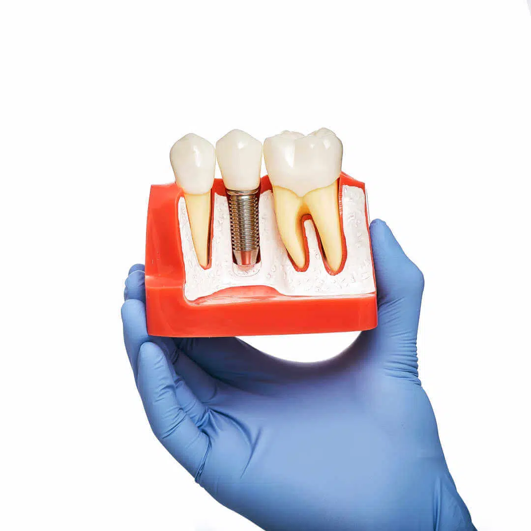 Zahnersatz zum Nulltarif* beim Fair Doctors Zahnarzt in Köln, Neuss und ganz NRW