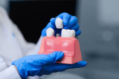 Zahnersatz zum Nulltarif* - Ihr Fair Doctors Zahnarzt in NRW