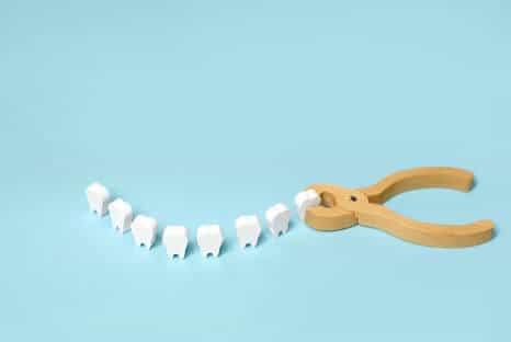 Zahnfehlstellung korrigieren bei Erwachsenen - Fair Doctors Zahnarzt - NRW