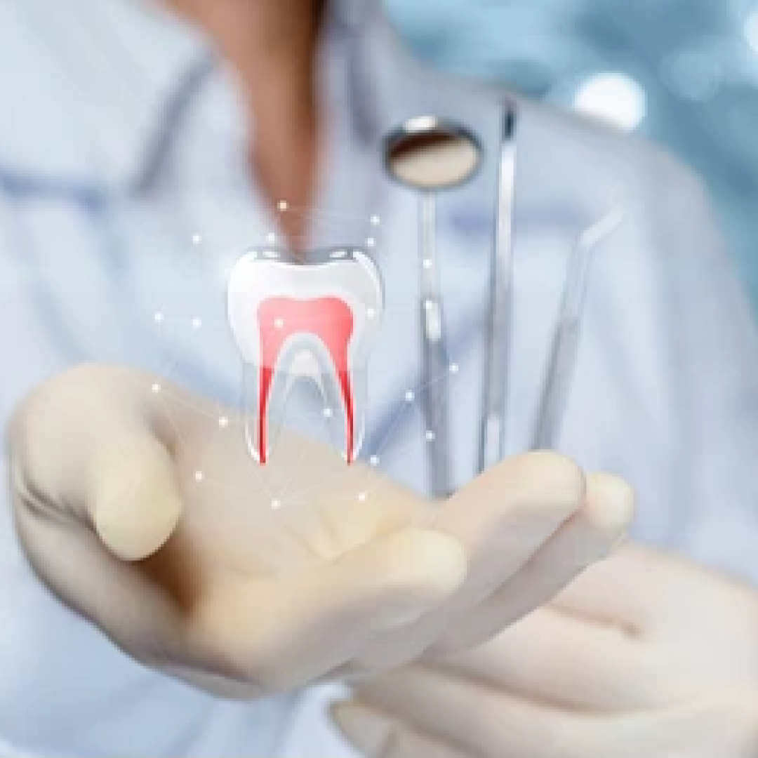 Zahnfleischtaschen reinigen - Behandlung und Zahnfleischtaschenreinigung beim Zahnarzt