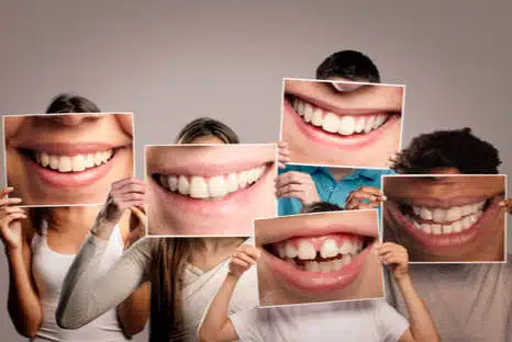 Zahnschmelzdefekt & Zahnschmelz aufbauen - Fair Doctors Zahnarztpraxis in NRW, Zahnschmelzdefekte