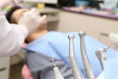 Fluorosen, Fluorose entfernen und behandeln beim Fair Doctors Zahnarzt