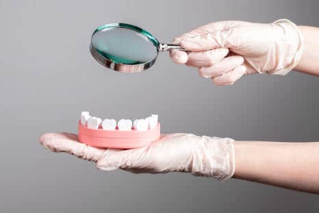 Kreidezähne Ursache und Behandlung, Fair Doctors Zahnarztpraxis NRW