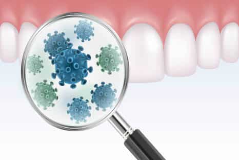 Zahnbakterien, Parodontose Bakterien, Fair Doctors Zahnarztpraxis in NRW