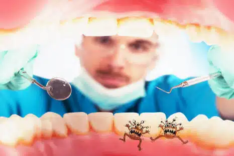 Zahnbakterien oder Parodontose Bakterien entfernen beim Zahnarzt in NRW