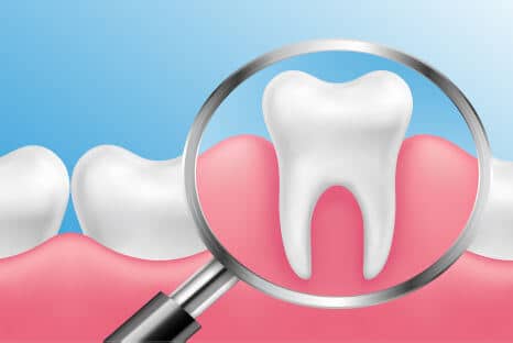Zahnfleischschwund und Zahnfleischrückgang Stoppen, Fair Doctors Zahnarztpraxis in NRW
