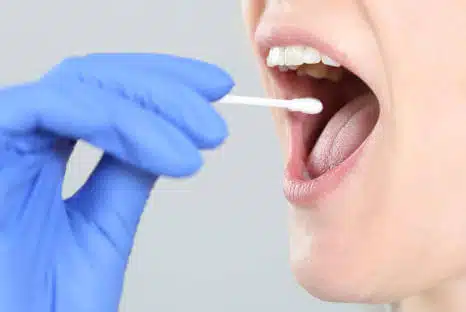 Mundschleimhaut, Mundschleimhauterkrankung, Behandlung, Fair Doctors Zahnarztpraxis NRW