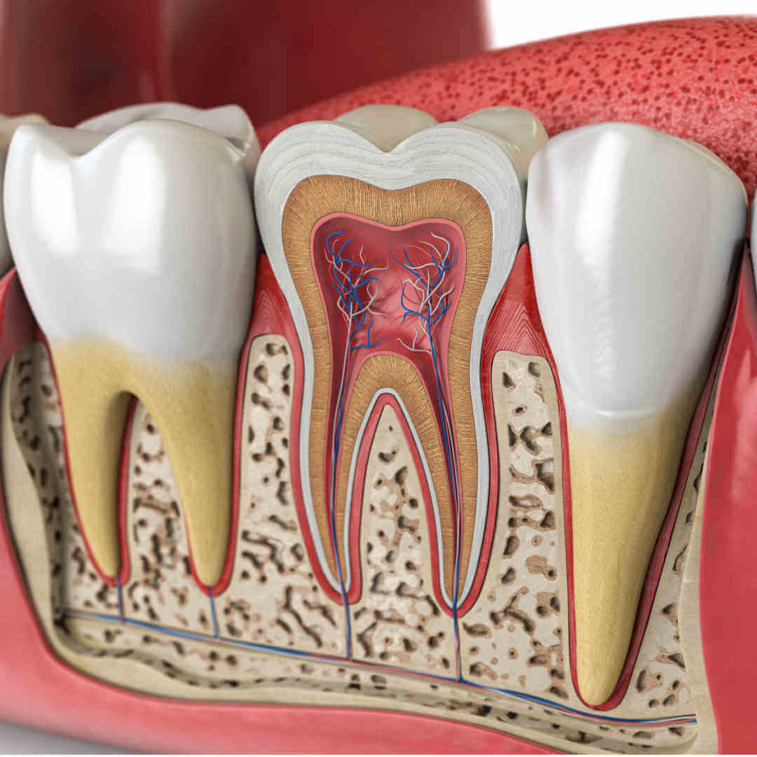 Wurzelkanalbehandlung, Wurzelbehandlung, Zahnwurzelbehandlung beim Fair Doctors Zahnarzt