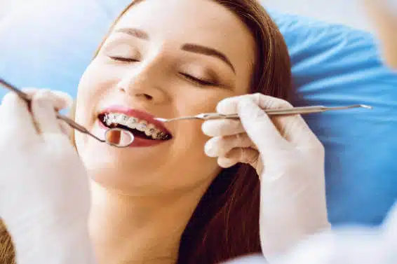 Feste Zahnspangen, Zahnfehlstellungen und Kieferfehlstellungen Korrektur