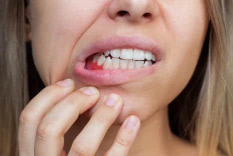 Mundkrankheiten, Munderkrankungen, Zahnfleischprobleme, Fair Doctors Zahnarzt in NRW