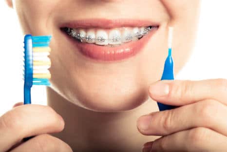 Zahnpflege, Menschen mit Zahnspange, Fair Doctors Zahnarzt NRW