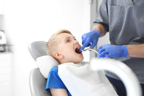 Zahnversiegelung bei Fair Doctors in NRW, Schutz vor Karies