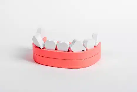 Zahnfehlstellung, Zahnfehlstellungen korrigieren, Fair Doctors Zahnarztpraxis NRW