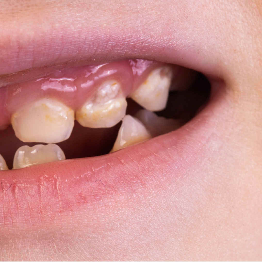 Kaputte und schlechte Kinderzähne, Fair Doctors, Zahnarzt NRW