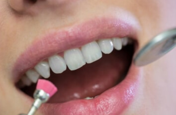 zahnarzt-professionelle-zahnreinigung-zahnarztpraxis-bonn-tannenbusch