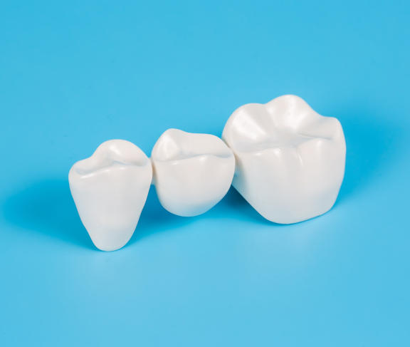 Preiswerter Zahnersatz aus Vollkeramik, Zahnarzt NRW