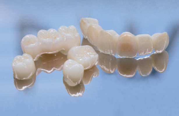 Zahnersatz aus Vollkeramik, Vollkeramischer-Zahnersatz